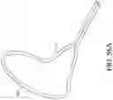 Fig. 62 - Axial lengthening thrombus capture system
