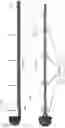 Fig. 67 - Axial lengthening thrombus capture system