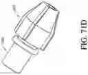 Fig. 76 - Axial lengthening thrombus capture system