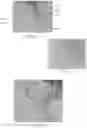 Fig. 05 - Capture-tool for manipulating and entubulating nerves