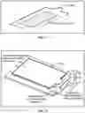 Fig. 04 - Pixel array medical systems, devices and methods