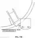 Fig. 16 - Pixel array medical systems, devices and methods