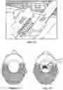 Fig. 40 - Pixel array medical systems, devices and methods