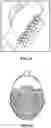 Fig. 41 - Pixel array medical systems, devices and methods