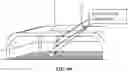 Fig. 80 - Pixel array medical systems, devices and methods