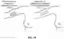 Fig. 94 - Pixel array medical systems, devices and methods