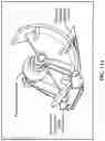 Fig. 15 - Pixel array medical devices and methods