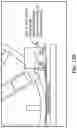 Fig. 18 - Pixel array medical devices and methods