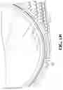 Fig. 24 - Pixel array medical devices and methods