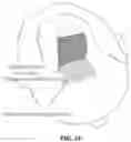 Fig. 35 - Pixel array medical devices and methods