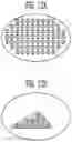 Fig. 09 - APPARATUS FOR PUNCTURING MAXILLARY SINUS