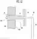 Fig. 16 - APPARATUS FOR PUNCTURING MAXILLARY SINUS