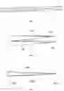 Fig. 04 - Intravascular memory metal puncture system and use thereof