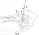 Fig. 04 - INSTRUMENTS AND METHODS FOR MYOMA RETRACTION