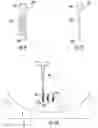 Fig. 07 - INSTRUMENTS AND METHODS FOR MYOMA RETRACTION