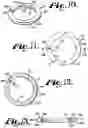 Fig. 05 - Pivotal bone anchor assembly having insert with rotation blocking extensions and downward facing collet