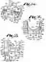 Fig. 06 - Pivotal bone anchor assembly having insert with rotation blocking extensions and downward facing collet