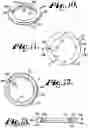 Fig. 05 - Pivotal bone anchor assembly having insert with rotation blocking extensions and downward facing collet