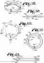 Fig. 19 - Pivotal bone anchor assembly having insert with rotation blocking extensions and downward facing collet
