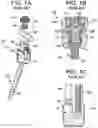Fig. 02 - Multipoint fixation implants