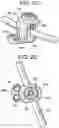Fig. 04 - Multipoint fixation implants