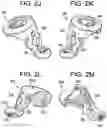 Fig. 07 - Multipoint fixation implants
