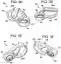 Fig. 09 - Multipoint fixation implants