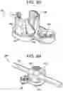 Fig. 10 - Multipoint fixation implants
