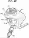 Fig. 14 - Multipoint fixation implants