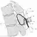 Fig. 01 - Flexible fastening system
