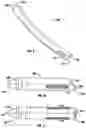 Fig. 07 - Devices and methods for inserting a vertebral fixation member