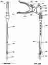 Fig. 22 - Devices and methods for inserting a vertebral fixation member