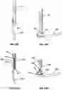 Fig. 28 - Devices and methods for inserting a vertebral fixation member