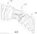 Fig. 06 - Transdiscal screw