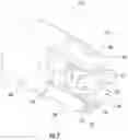 Fig. 08 - Transdiscal screw