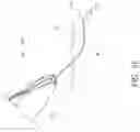 Fig. 10 - Methods and systems for preventing neuroma formations