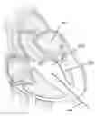 Fig. 01 - Method and device for interventricular septal ablation