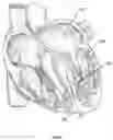 Fig. 07 - Method and device for interventricular septal ablation