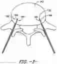 Fig. 04 - Dispersive return pad with phase change material for active thermal management during an ablation procedure