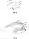Fig. 06 - Modeling a collapsed lung using CT data