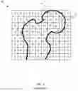 Fig. 04 - Intraoperative adjustment of a pre-operatively planned implant cavity to improve implant fit