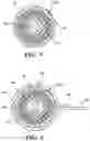 Fig. 04 - Collapsible detection antenna for surgical articles