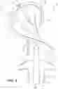 Fig. 06 - Collapsible detection antenna for surgical articles