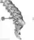 Fig. 10 - Robotic navigation of robotic surgical systems