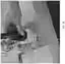 Fig. 24 - Robotic navigation of robotic surgical systems