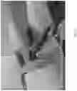 Fig. 26 - Robotic navigation of robotic surgical systems