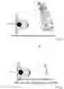 Fig. 31 - Robotic navigation of robotic surgical systems
