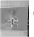 Fig. 34 - Robotic navigation of robotic surgical systems