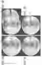 Fig. 04 - System and method for image localization of effecters during a medical procedure