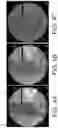 Fig. 05 - System and method for image localization of effecters during a medical procedure